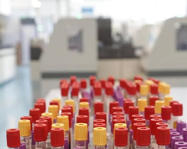 A Francoforte, i casi di malaria salgono a otto: tre decessi nell'area dell'aeroporto